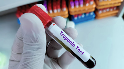 Labor Bluttest Troponin