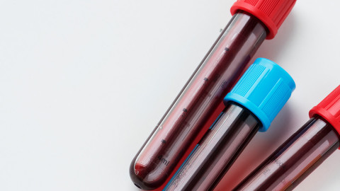 Bild von drei Blutproben