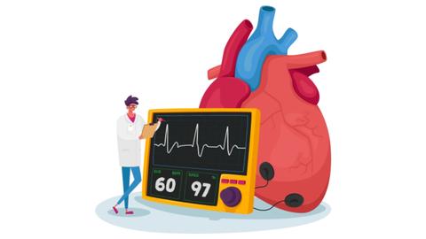 Bild von einem Herzen und EKG