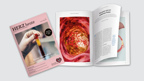 Titelbild der HERZheute mit einer offenen Magazin-Seite